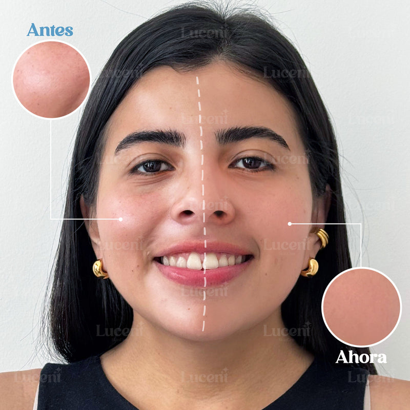 Candy Bella® | Adiós a la Grasa Facial – ¡Envío Gratis Hoy!